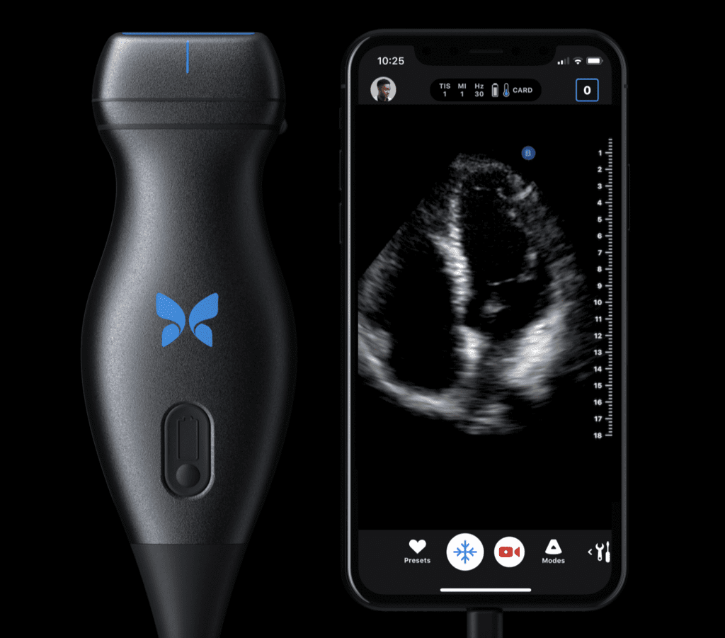 The ButterflyiQ's personal ultrasound tool won Best of Show honors at SXSW.