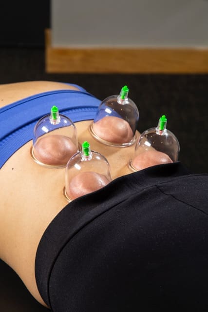 Cupping was popularized by professional athletes, like Michael Phelps.  (Photo by Pendleton Photography)